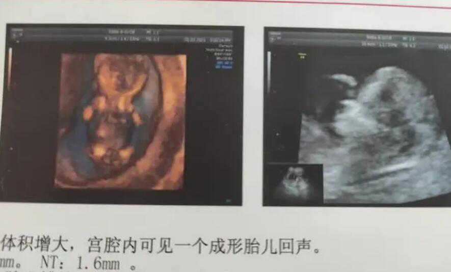 上海地下精子qq群 上海供卵不排队医院汇总整理 ‘b超看屁股查男女准吗’